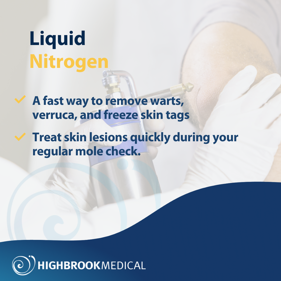Liquid nitrogen treatment Remove warts and verruca Highbrook